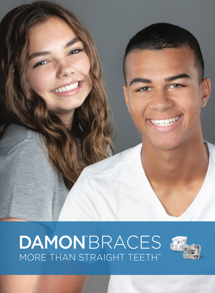 Braces Sydney Cheap And Affordable Braces In Sydney